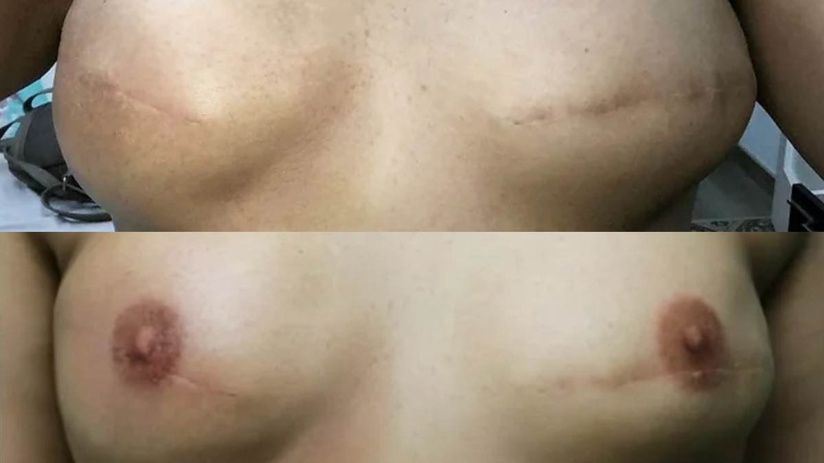 Imatge d'un tatuatge oncològic.  - Cedida / Mireia Ortega