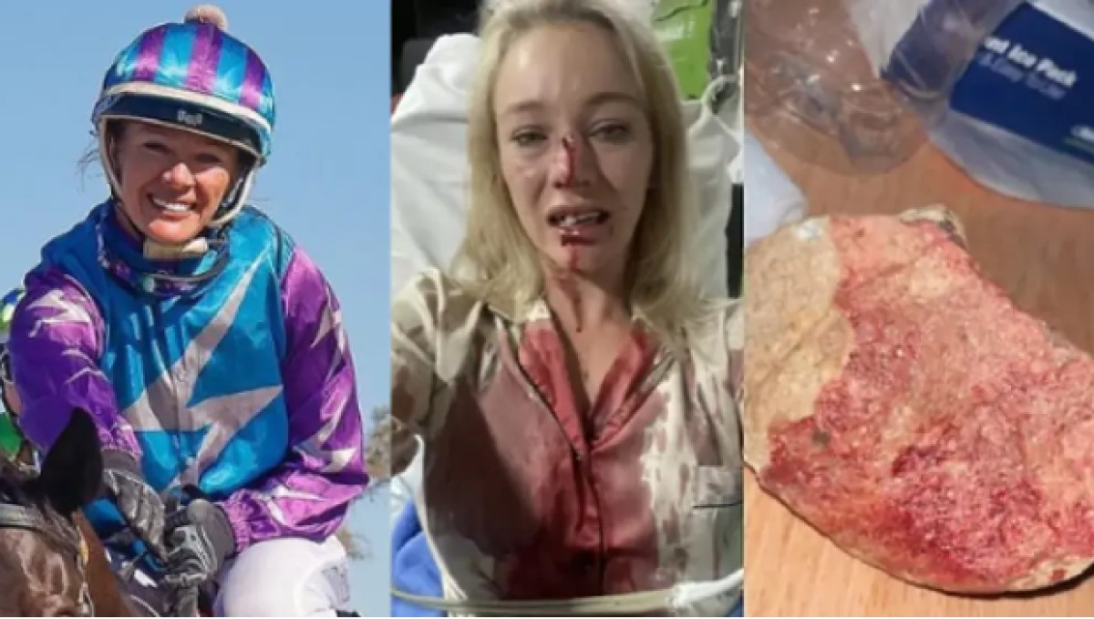 Ataquen brutalment amb una pedra una joquei australiana per robar-li el cotxe