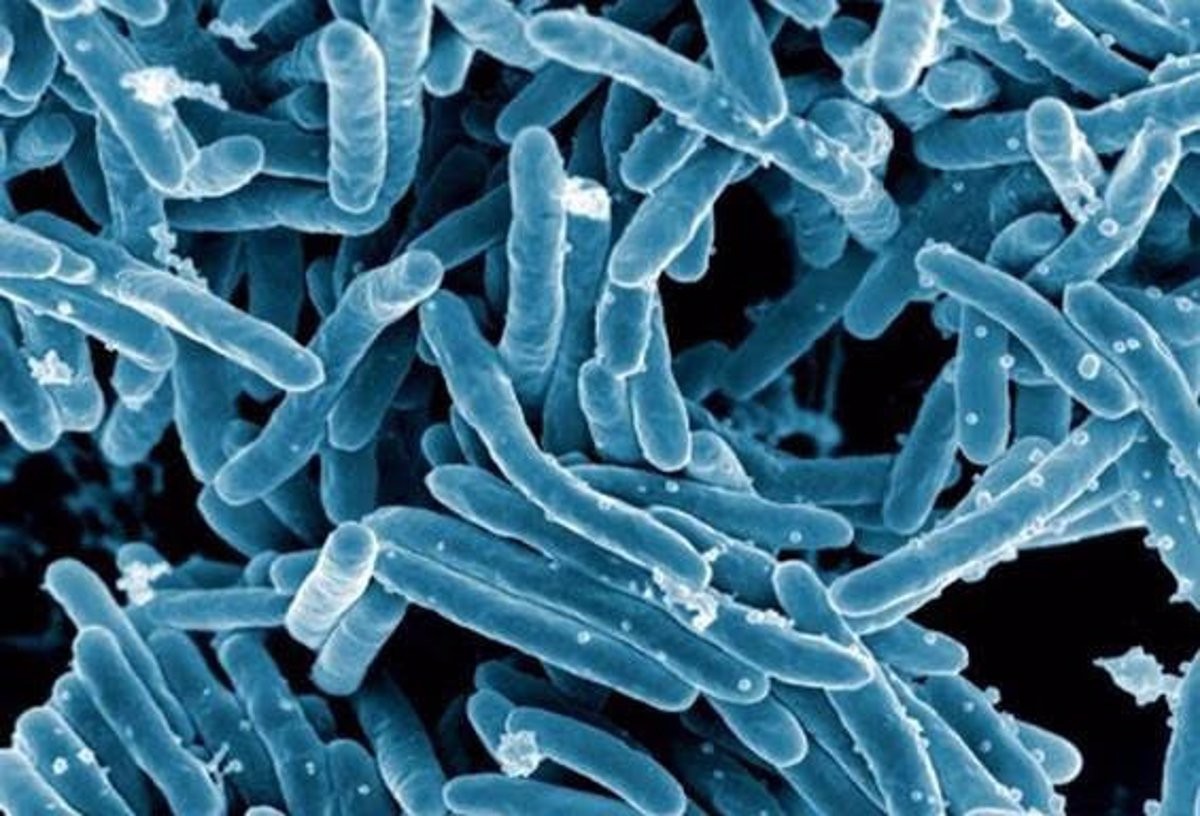 Detecten un brot de tuberculosi en un institut de Galícia: ja hi ha 19 casos