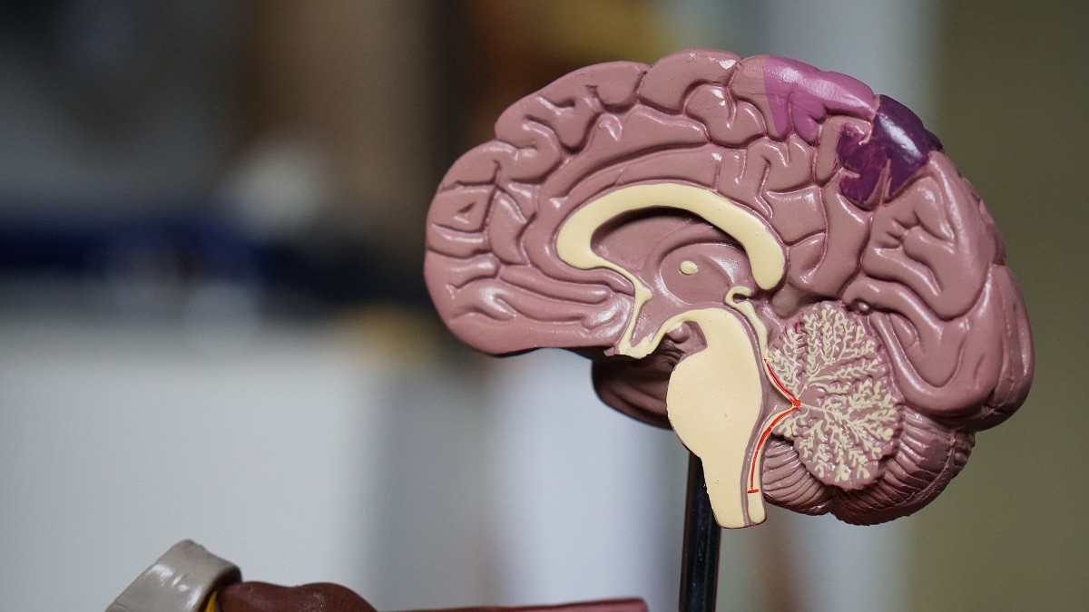 Un estudi revela que el colesterol i la hipertensió incrementen el risc de patir Alzheimer