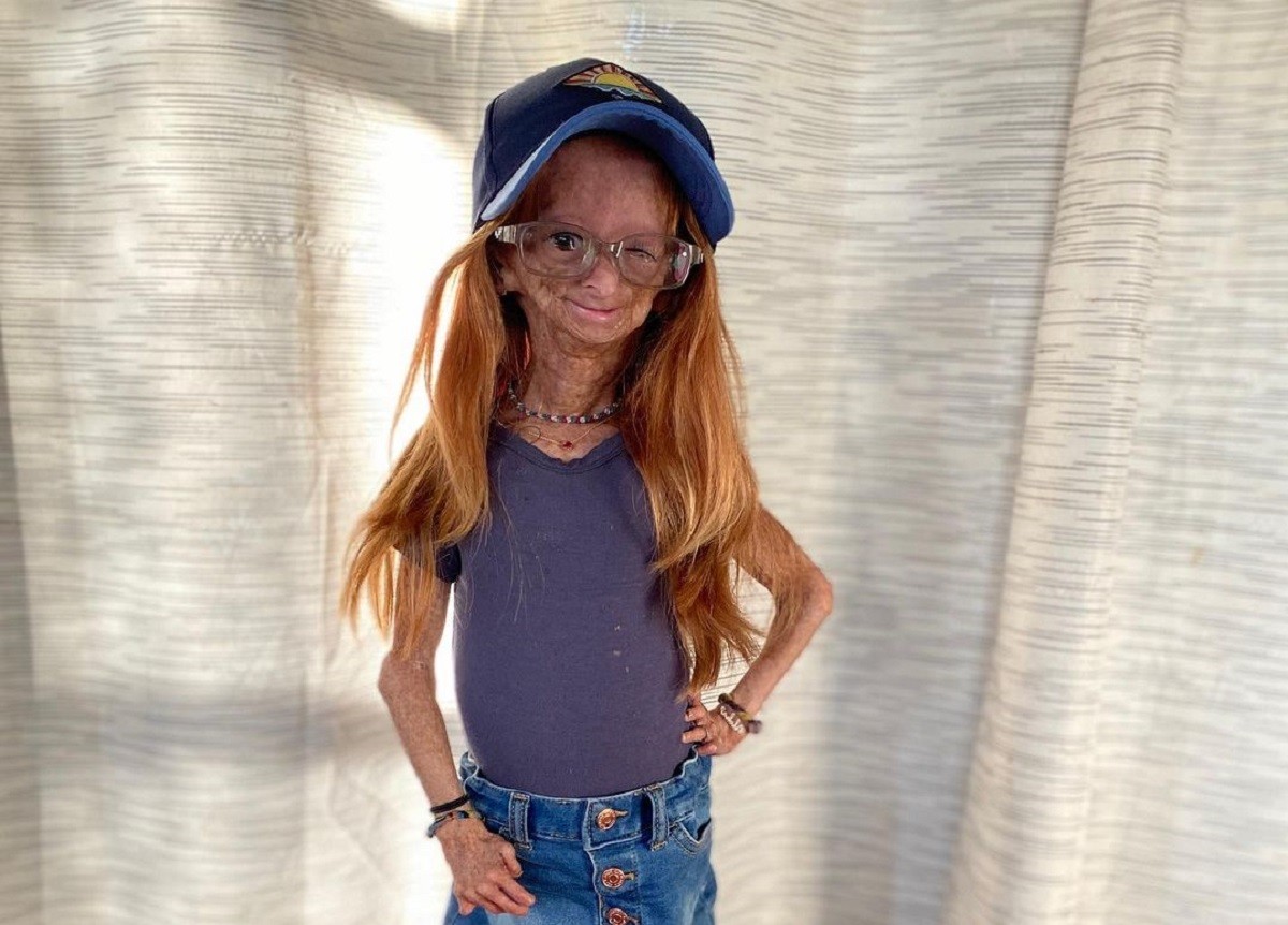 Mor als 15 anys Adalia Rose, la youtuber que va conscienciar sobre la progèria