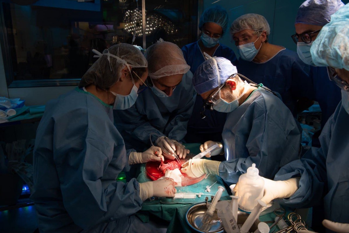 L'Hospital Clínic realitza el seu segon trasplantament d'úter amb èxit
