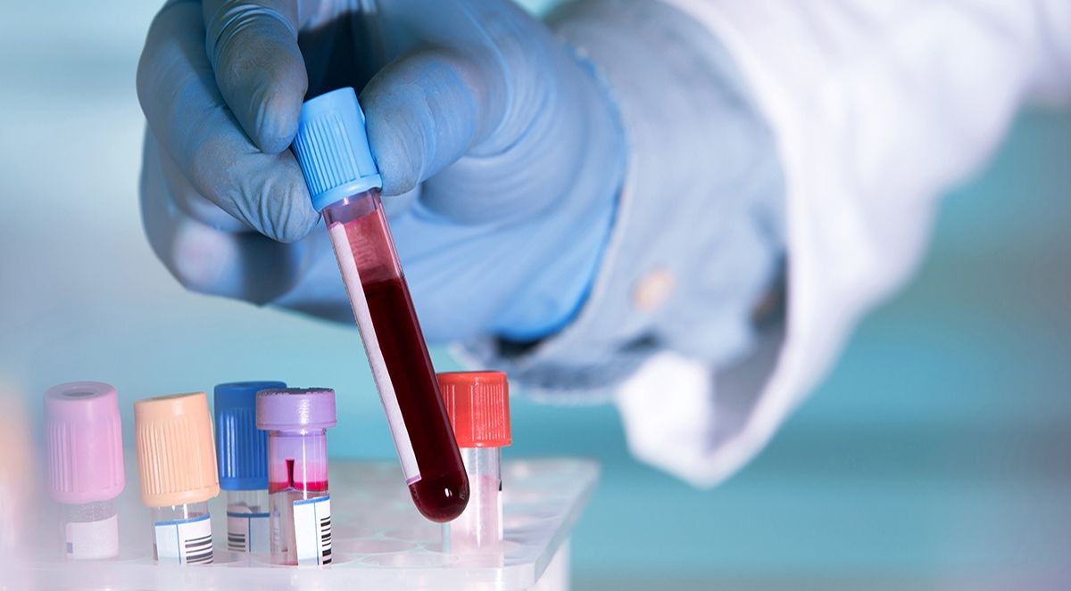 Una mostra de sang en un laboratori - Blueberry Diagnostics
