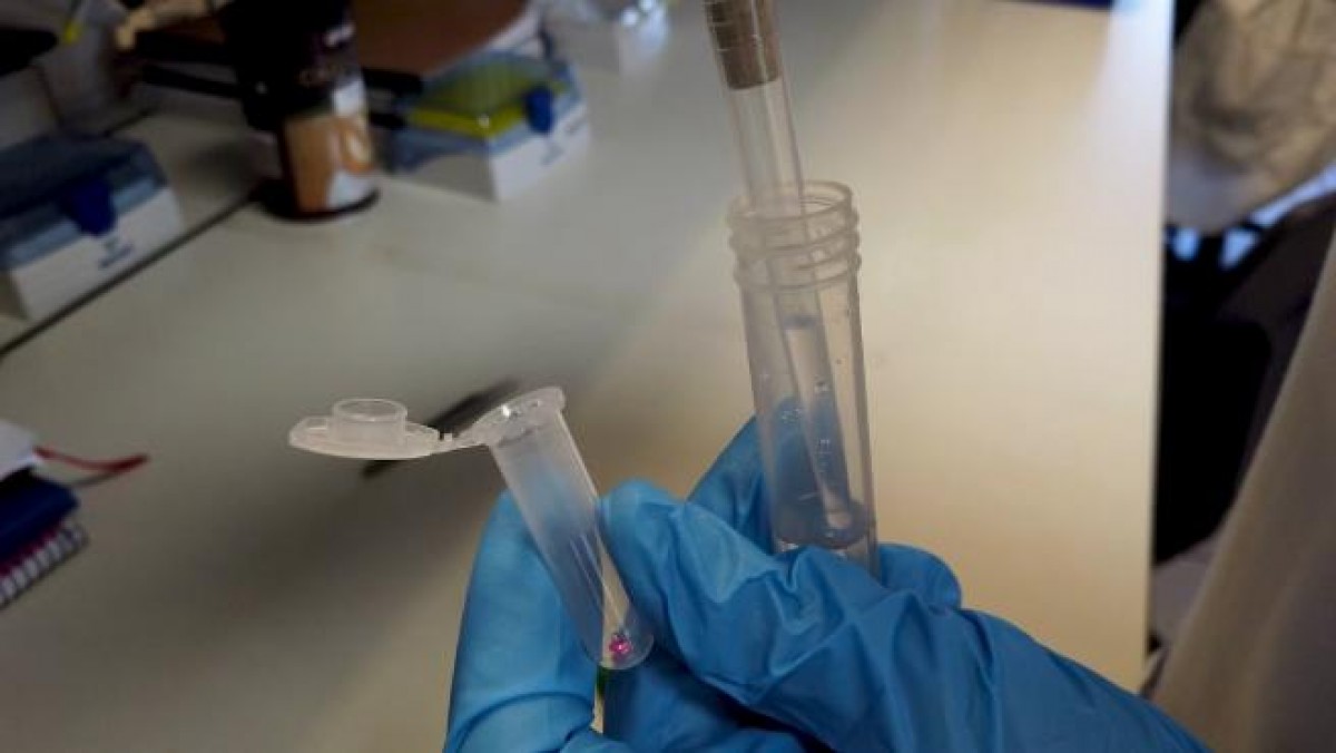 Investigadors catalans descobreixen un nou mecanisme de defensa cel·lular contra virus i bacteris