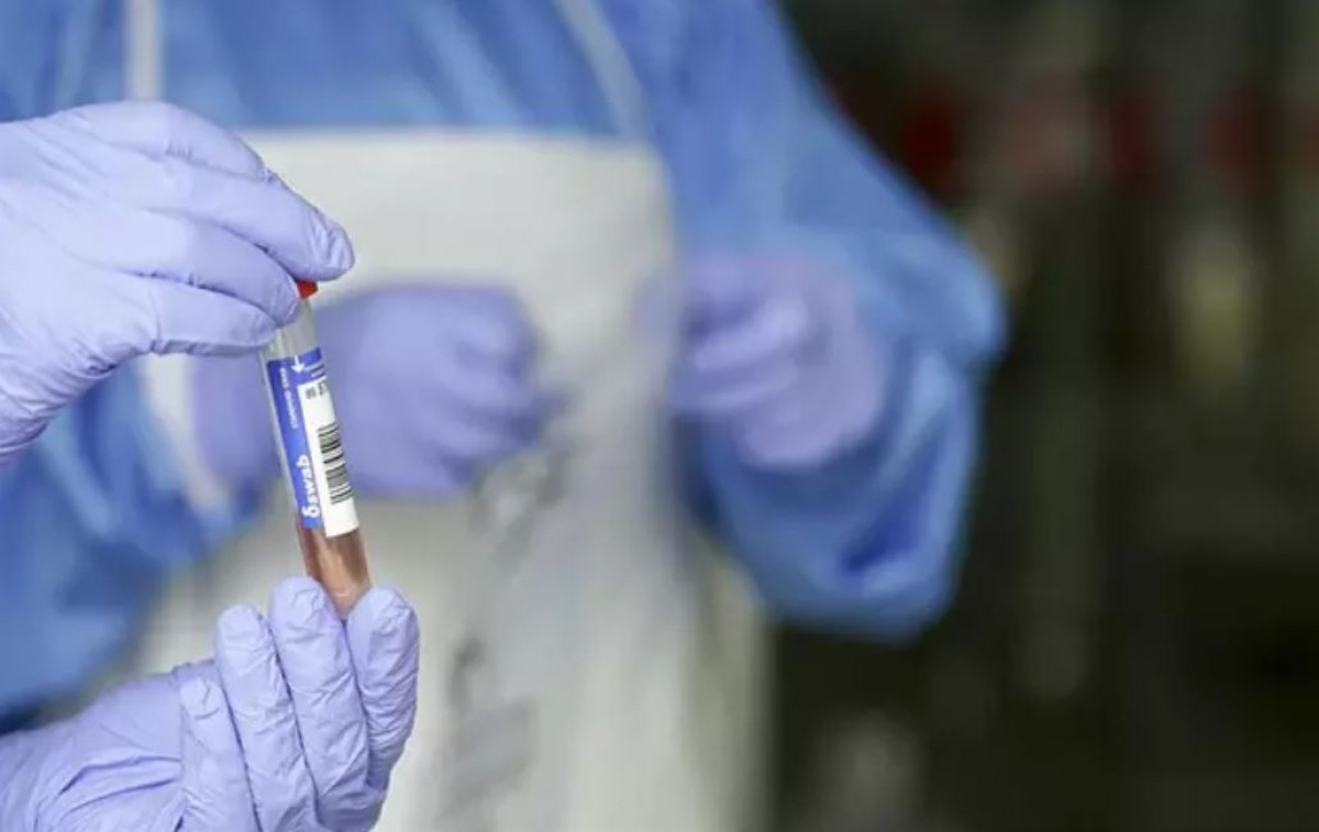 Una mostra en un laboratori - Europa Press