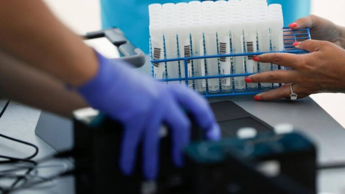Un dels medicaments contra el dany pulmonar - Algernon Pharmaceuticals