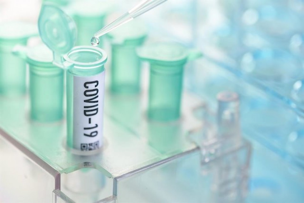 Nous descobriments contra el coronavirus - Getty