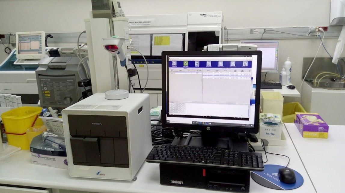La Clínica Terres de l'Ebre de Tortosa es reforça amb la implementació dels nous test de detecció ràpida de la Covid-19