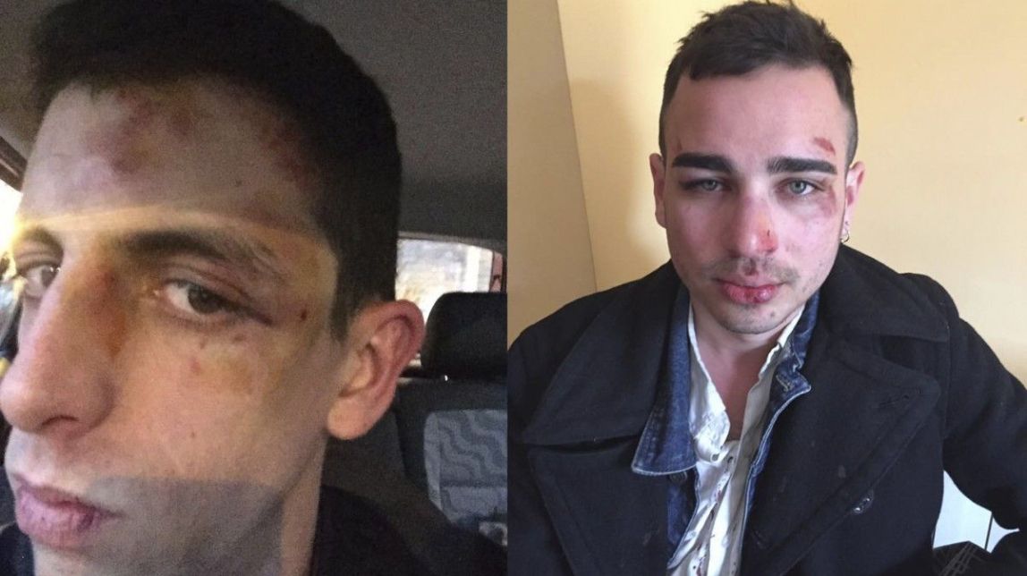 Una de les víctimes de l'agressió homòfoba a Berga: «Estem destrossats anímicament»
