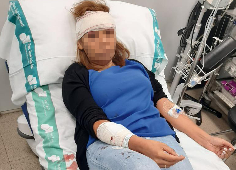 Un gos ataca una dona a Sabadell: 