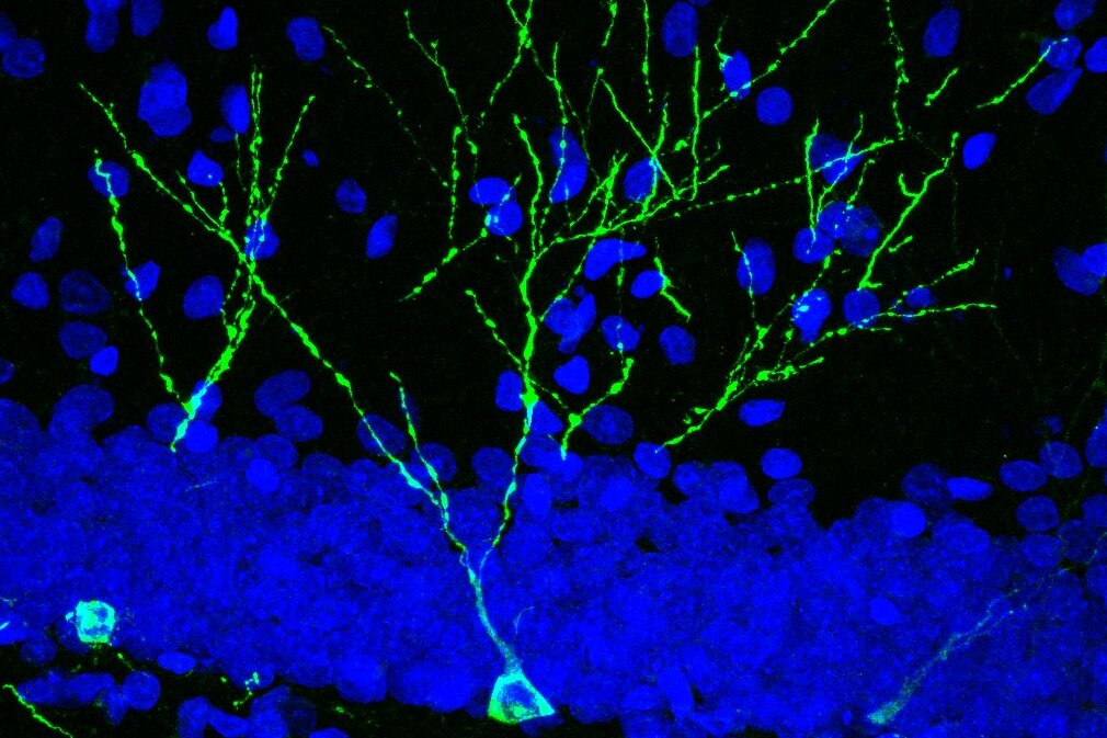 Una dieta hipocalòrica atenua canvis cerebrals vinculats a la pèrdua de memòria per edat