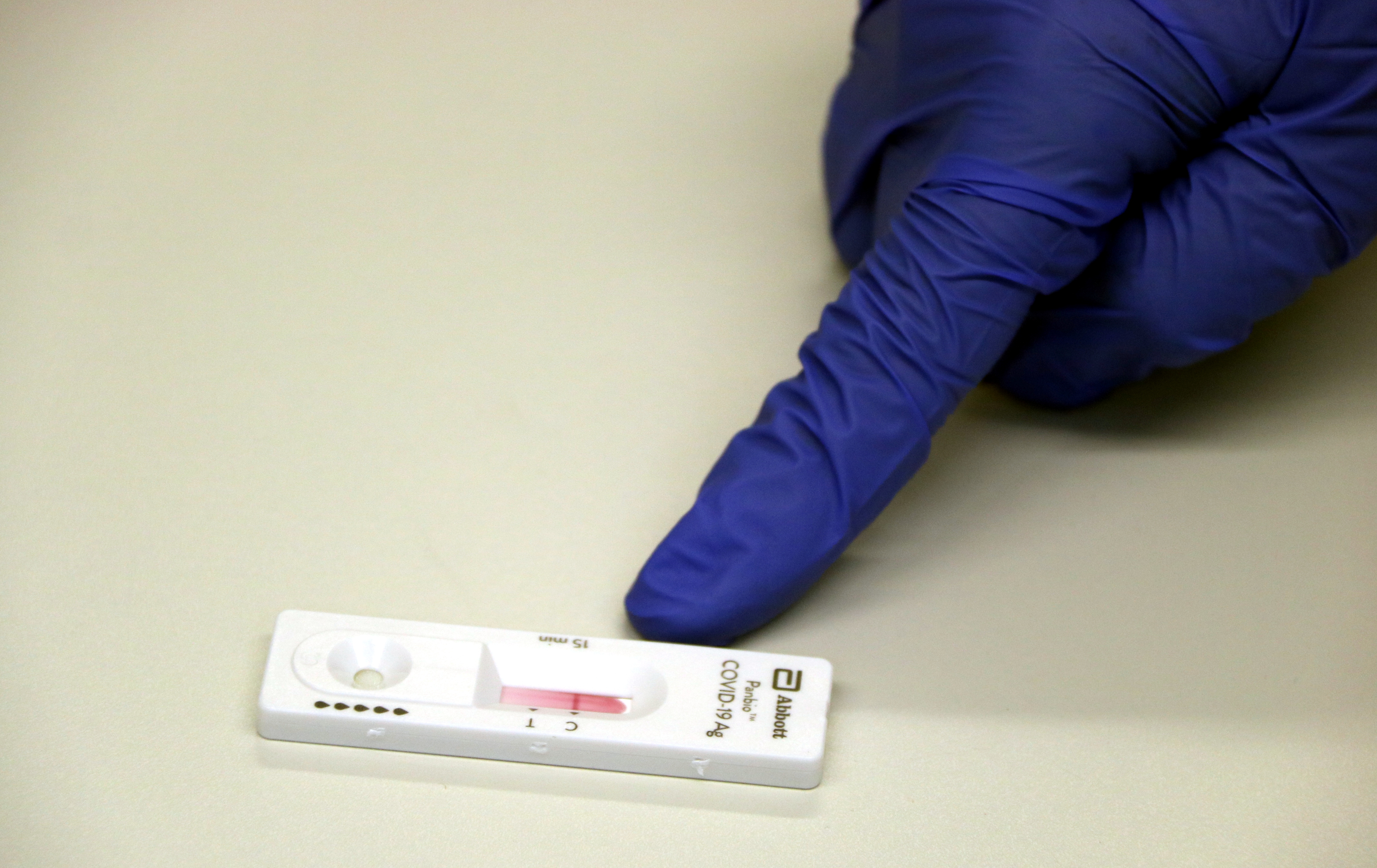 Les farmàcies podran dispensar al públic tests d'antígens i d'anticossos per la Covid-19