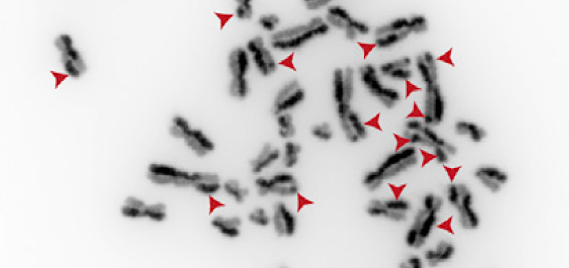 Un estudi amb participació de la UAB troba dos gens implicats en la síndrome de Bloom