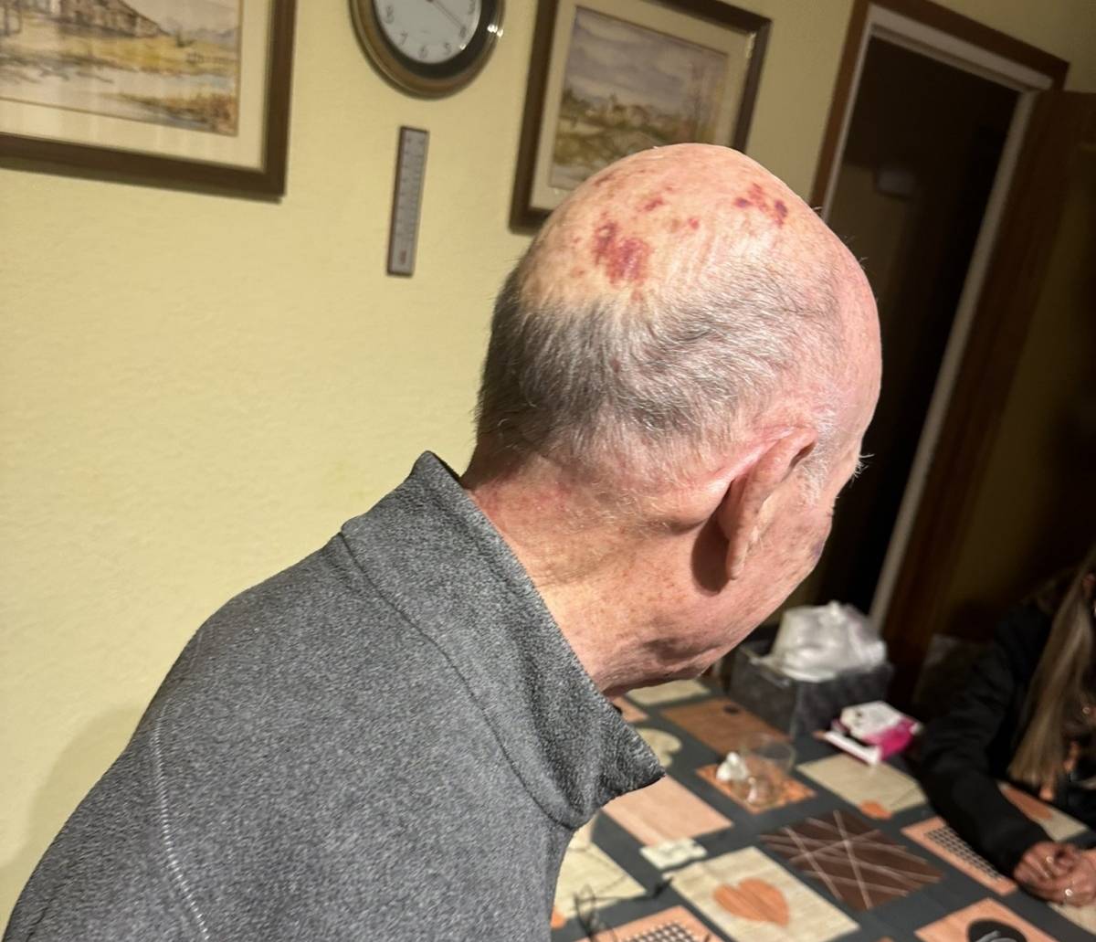 Detenen l'autor de la brutal agressió a dos avis nonagenaris a Sabadell