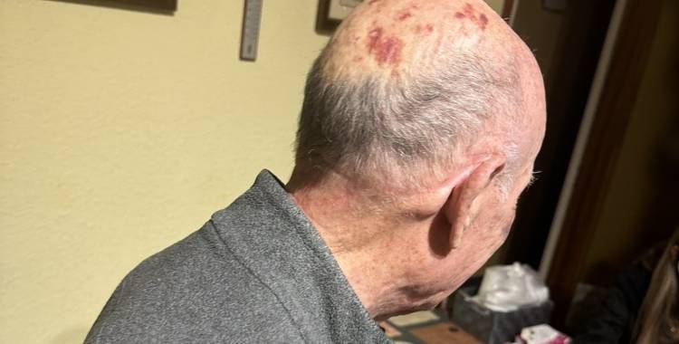 L'autor de la brutal agressió a dos avis de Sabadell, a la presó
