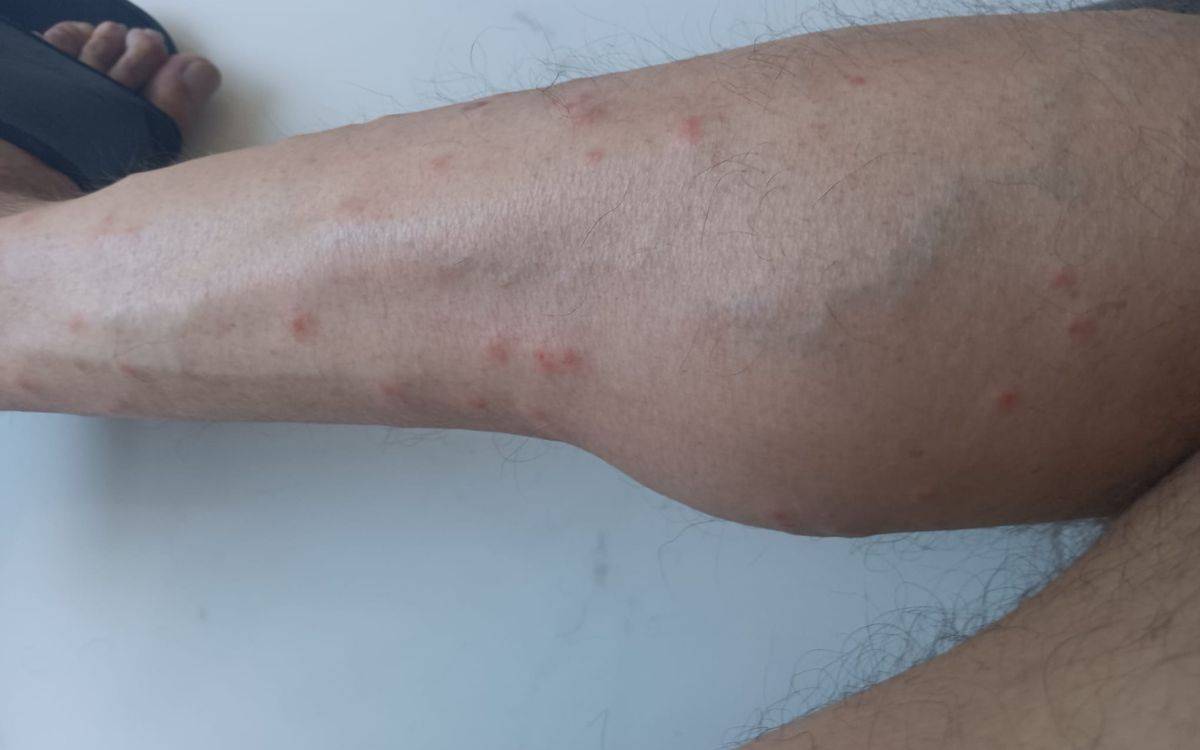 Denuncien una possible plaga de mosca negra a Campclar que afecta desenes de veïns