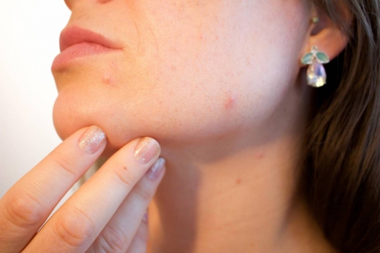 Consells per saber quin tipus de pell tens segons un dermatòleg