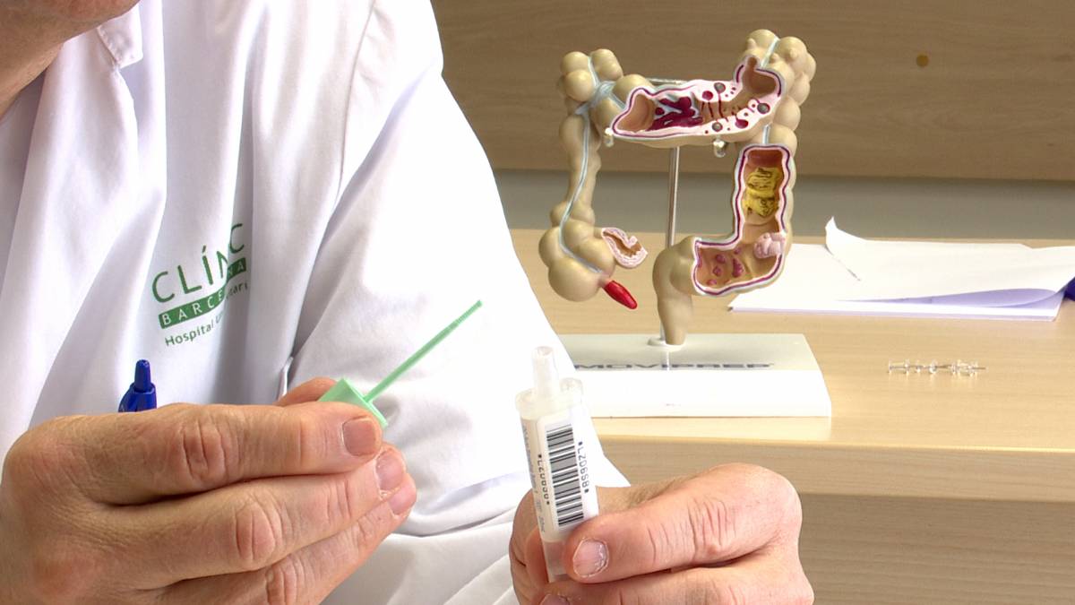 El càncer de còlon tindria una supervivència del 90% si es detectés a temps