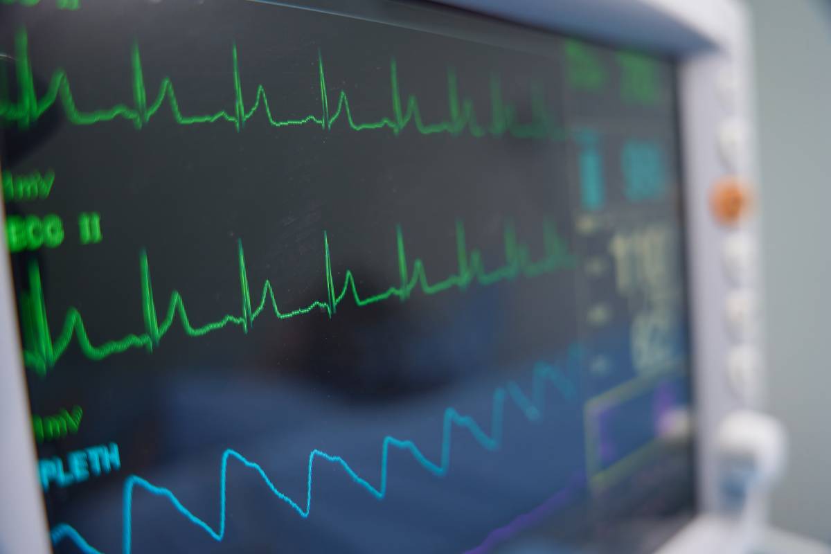 Arrítmia o ansietat? El truc senzill d'un doctor per diferenciar-ho