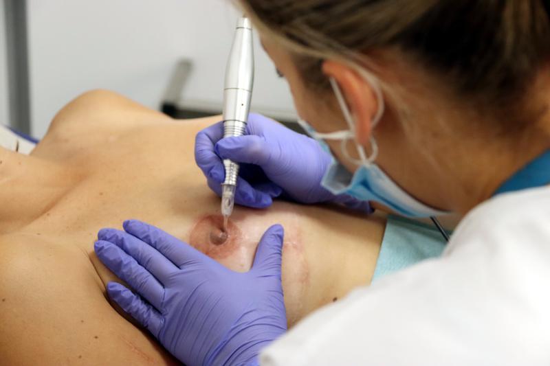 Sanitat amplia el cribratge de càncer de mama a dones d’entre 45 i 74 anys