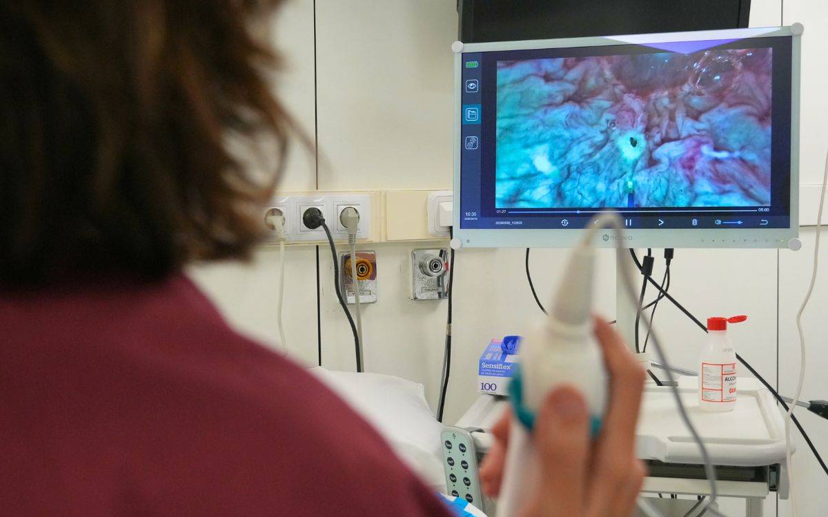 L'Hospital Joan XXIII de Tarragona inicia un tractament amb làser per a tumors de bufeta sense passar per quiròfan