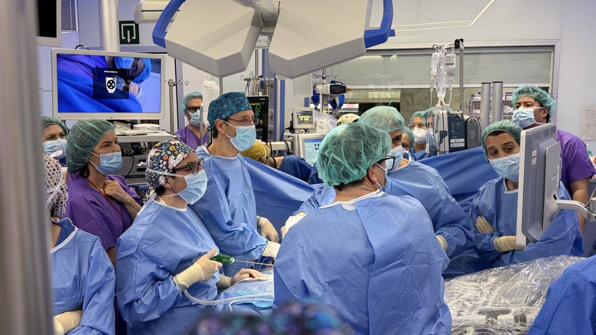 Operació pionera a Barcelona (i a Europa) a un fetus que havia desenvolupat els budells fora del cos