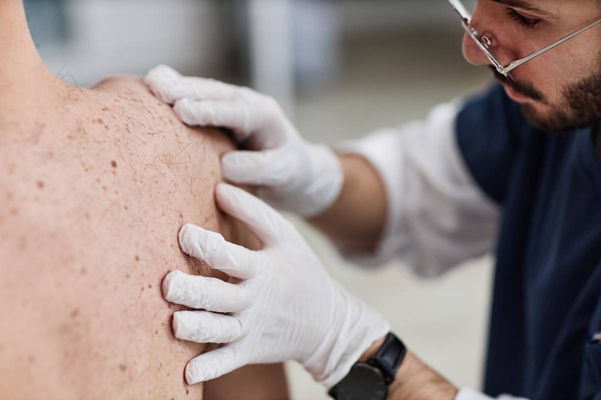 Les recomanacions d'un dermatòleg per evitar el càncer de pell: «El 80% són bons hàbits»