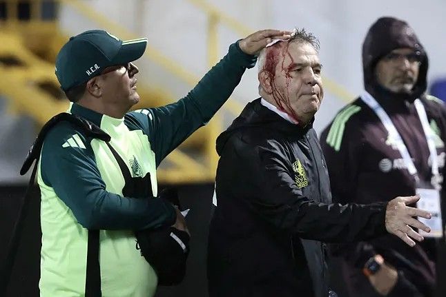 Un exentrenador de la lliga, agredit després de perdre amb la seva selecció
