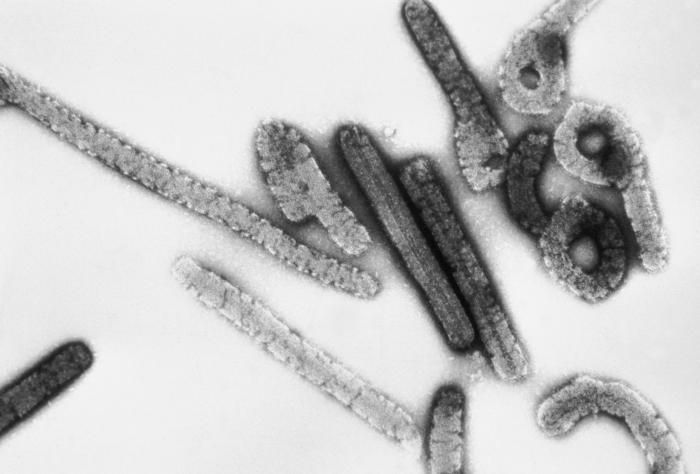 Preocupació a Ruanda per un virus sense vacuna que pot matar el 80% dels infectats