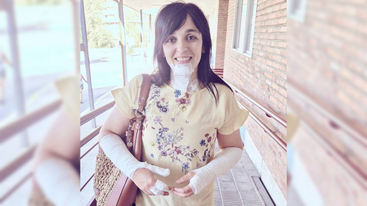 Sílvia Orriols pateix cremades a causa d'un accident domèstic